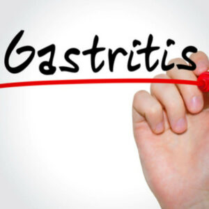 Descripción de la gastritis